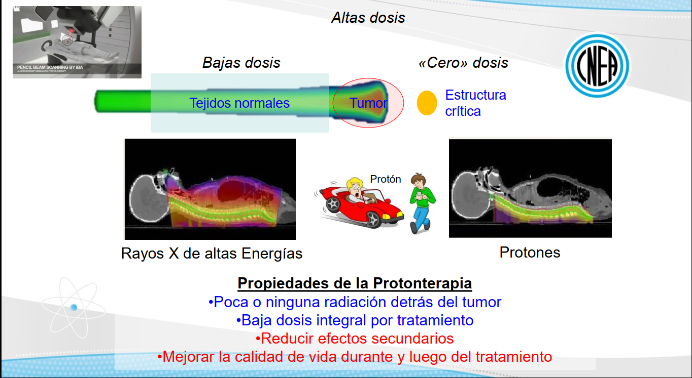 El dr. Gustavo Santa Cruz explica en qué consiste la técnica de la Protonterapia
