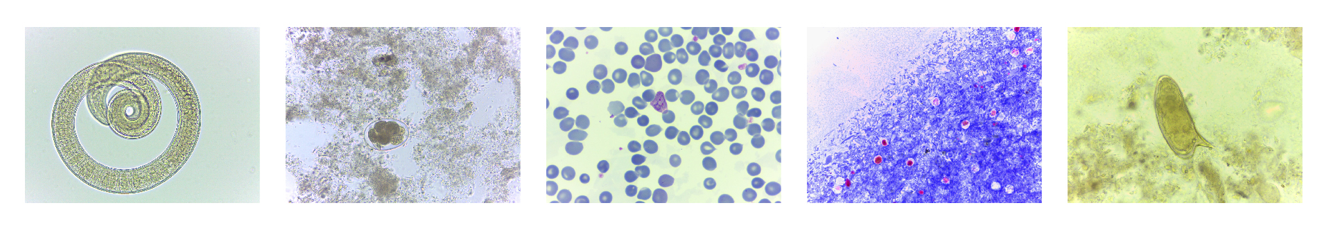 Trichinella spiralis | Uncinarias | Plasmodium vivax | Cryptosporidium sp.| Schistosoma mansoni Trichinella spiralis | Uncinarias | Plasmodium vivax | Cryptosporidium sp.| Schistosoma mansoni