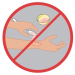 No colocar remedios caseros.