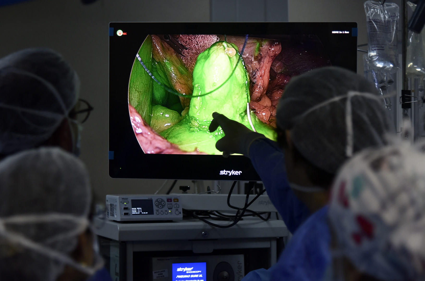 operacion_insulinoma_posadas