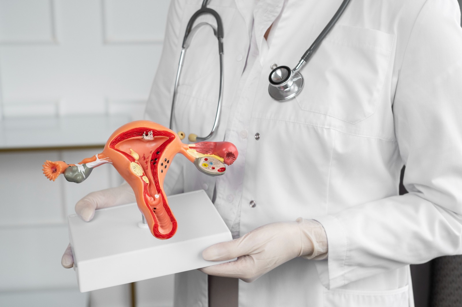 Imagen de un médico/a sosteniendo una maqueta del aparato reproductor femenino.
